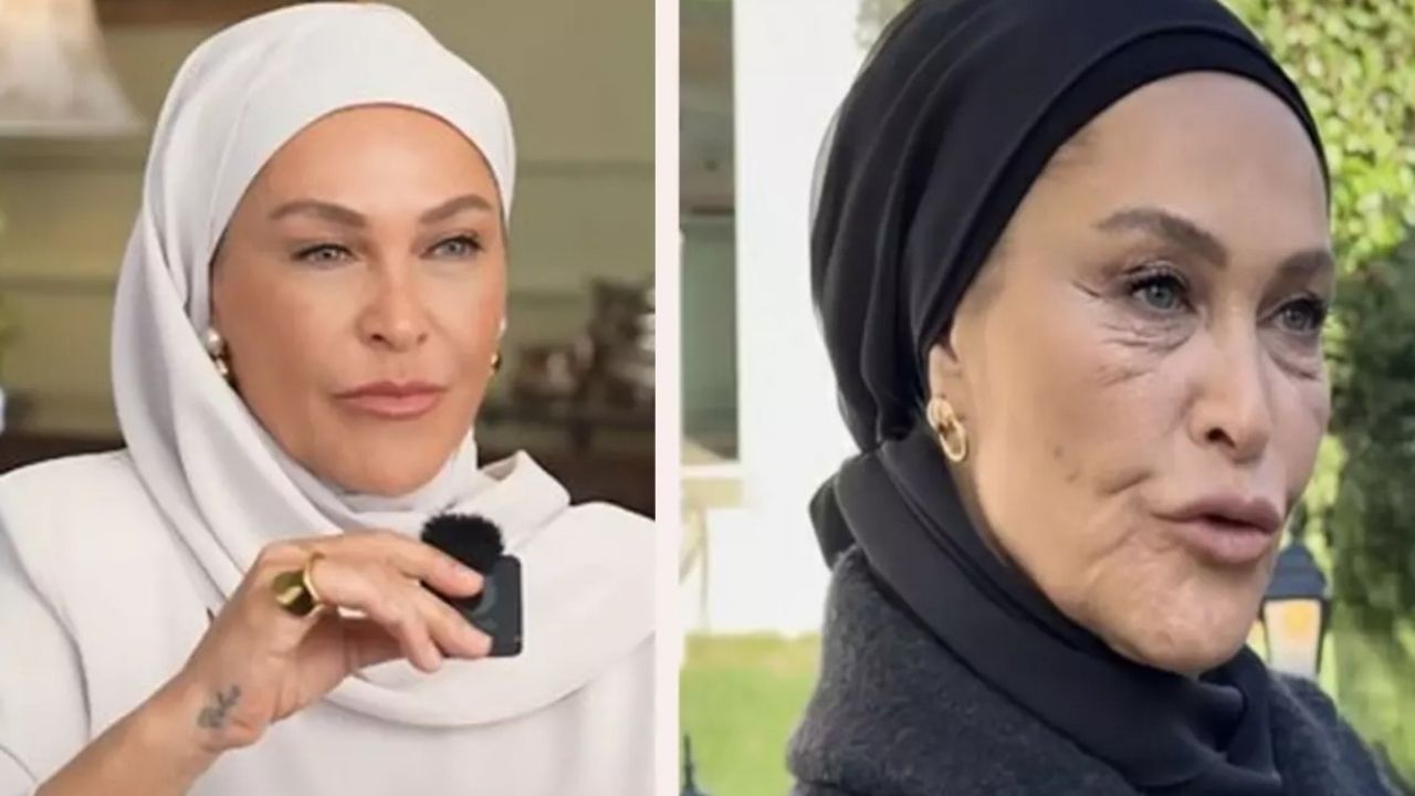 Ekran değil, sanki buğu camı:  Burnu bile kayboldu!